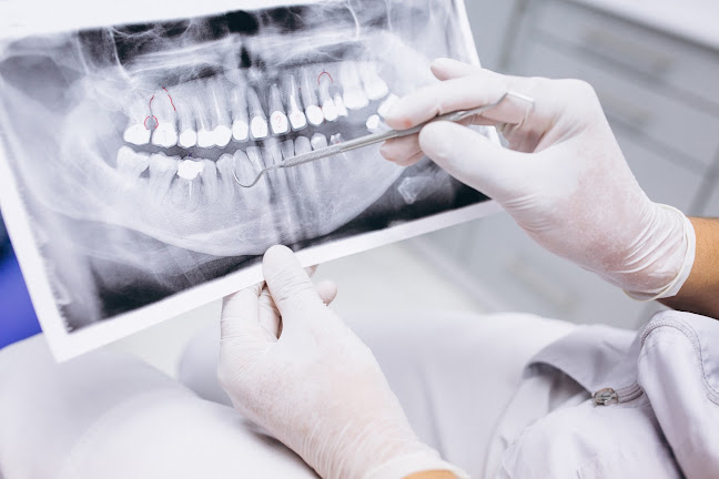 Dentalna rendgenska snimka iz javnog profila ordinacije K-Dent